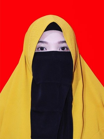 dr. Ratna Nurlaila ,M.Sc, Sp.D.V.E.