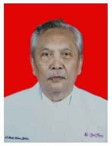 Dr. I Made Wisnu Sp.KK (K)