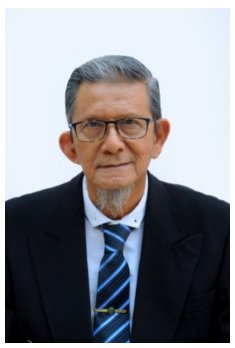 Prof. DR.Dr. H. Harijono Kariosentono Sp.D.V.E(K), FINSDV, FAADV