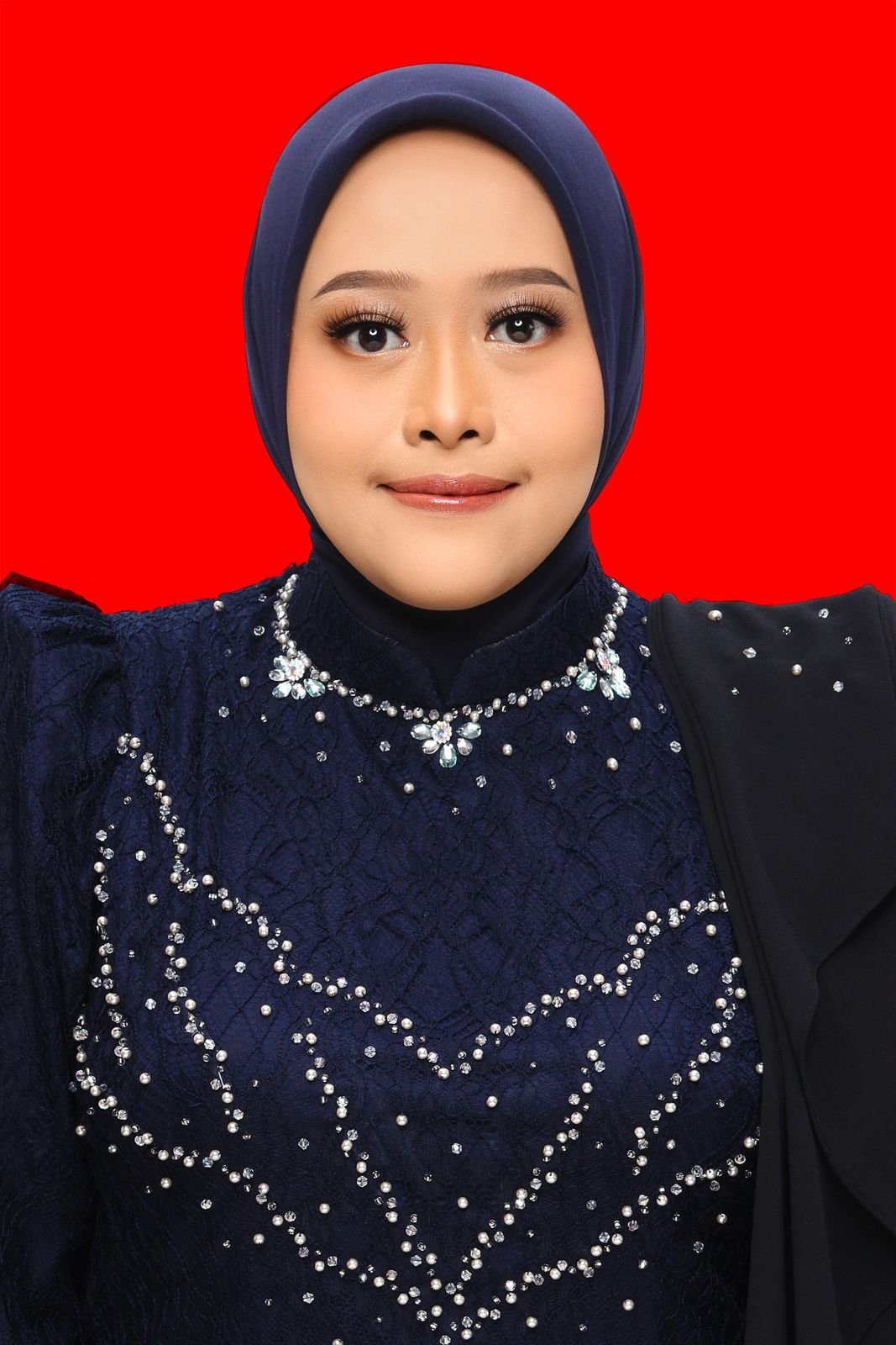 dr. Dixy Febrianita Titi Pratama Putri Sp. DV